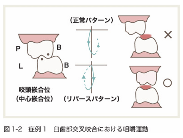 正しくない咀嚼