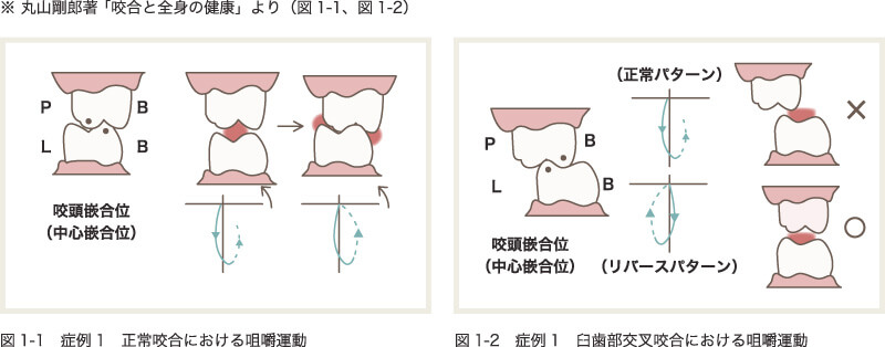 正しくない咀嚼